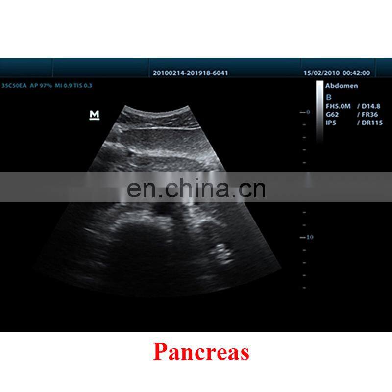 Cheapest Original Mindray DP-50 ultrasound portable ultrasonic diagnosis system/mindary ultrasound