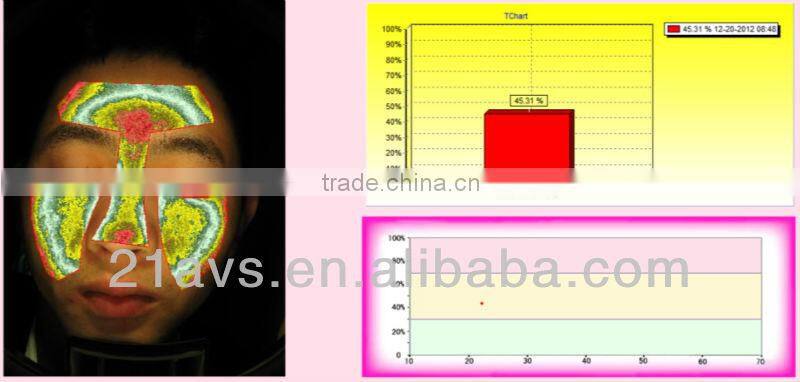 Professional Facial Skin Analyzer Magic Mirror with software system for beauty salon