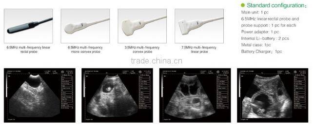 CE approved B mode Fully Digital Portable Ultrasound Scan Machine /scanner for pregnancy