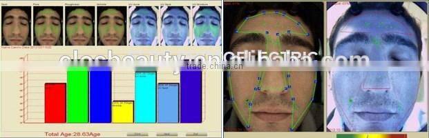 Professional Skin Analyzer Machine, skin test machine