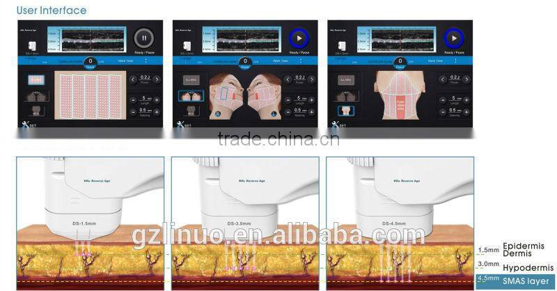 Hot sale portable HIFU machine for facial beauty