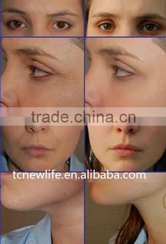 NL-TM800 2014 Hottest in USA!! Fractional RF&Microneedle Facial Treatment Beauty Body and Face