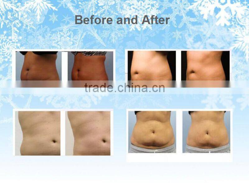 Newest beauty salon equipment sorisa beauty equipment