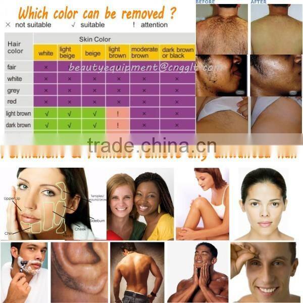 Germany 808nm diode laser hair removal