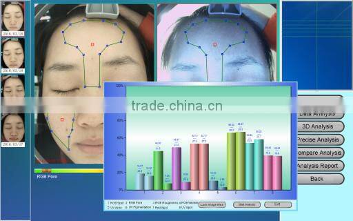 Factory direct sale 3d magic mirror skin analyzer portable type facial skin test machine