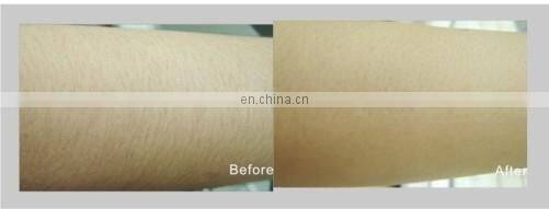 GSD Star product!!! Ipl and professional hair removal beauty machine with CE