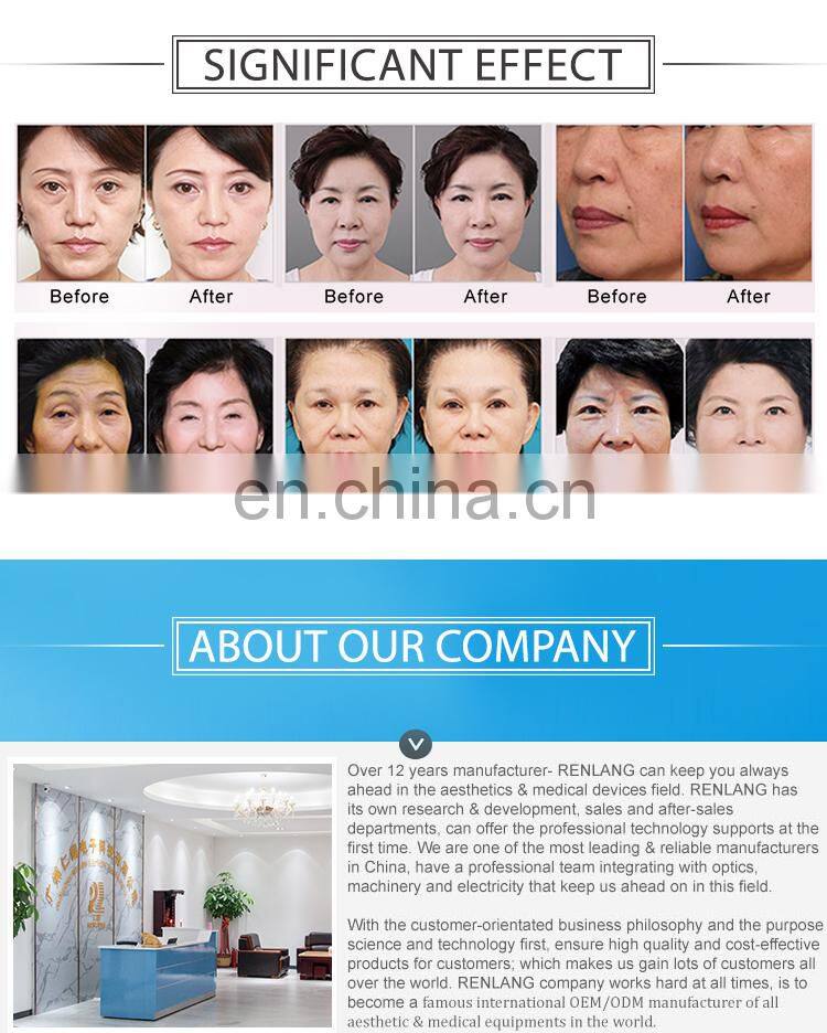 Factory price Portable radio frequency RF facial lifting body slimming machine