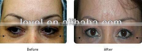 Professional Skin Resurfacing medical fractional co2 laser beauty machine