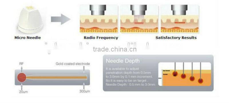Advanced high quality professional fractional radio frequency