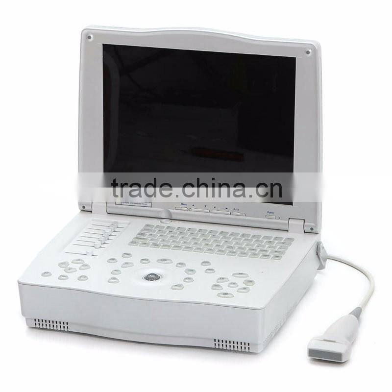 Hospital clinical equipment 15-inch full digital Laptop Ultrasound Scanner China made portable ultrasound machine