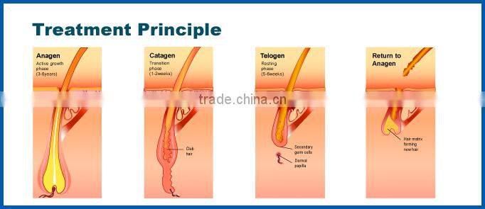 Surprised function beauty ipl machine