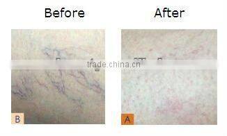 New Design IPL Machine RF Equipment Mutifunction E-light Beauty Device-C003