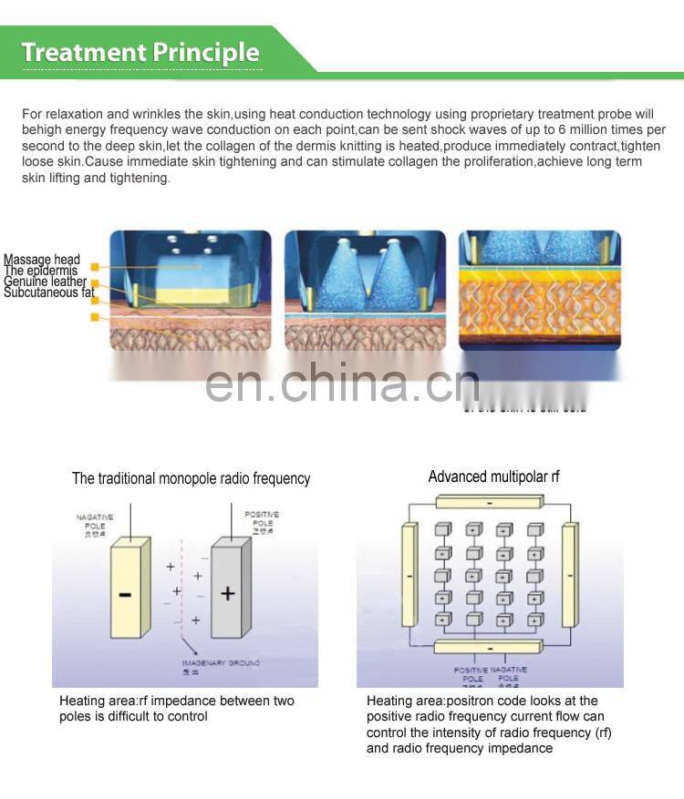 Anti-wrinkle ultrasonic cavitation radio frequency/rf beauty machine for home use