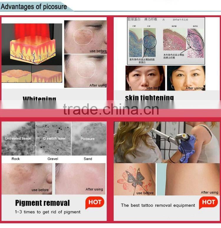 Active Q-Switch EQ Powerful 1064nm 532nm q-switch nd yag laser / nd yag laser machine