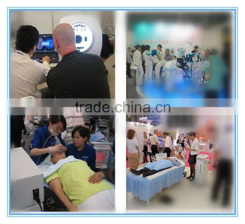 Professional 808nm laser diode hair removal germany