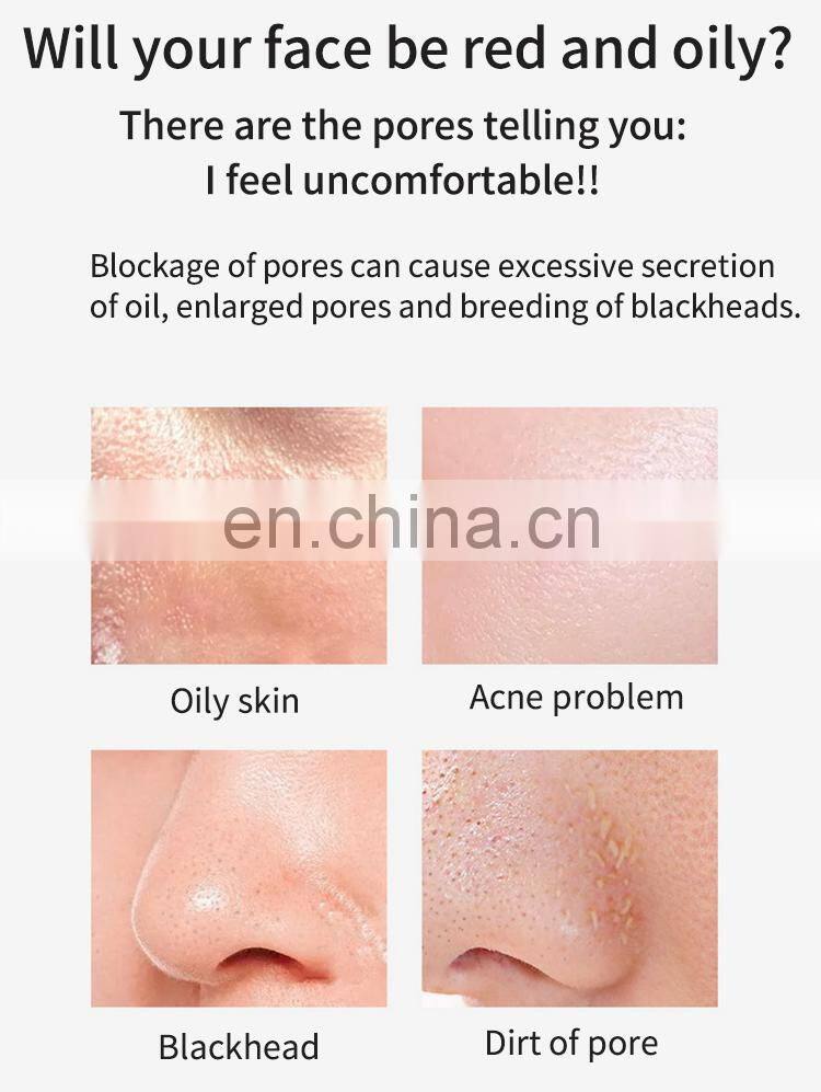 New products face scrubber ultrasonic facial scrubber beauty device