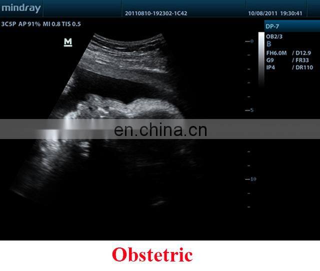 DP-7 Factory Price Mindray trolley Full digital DP-7 ultrasound machine price