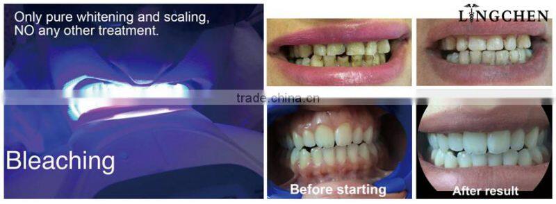 2016 newest style dental zoom teeth whitening machine with CE approved
