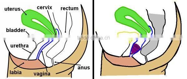 custom BPA/Dioxin Free Silicone reusable lady cup
