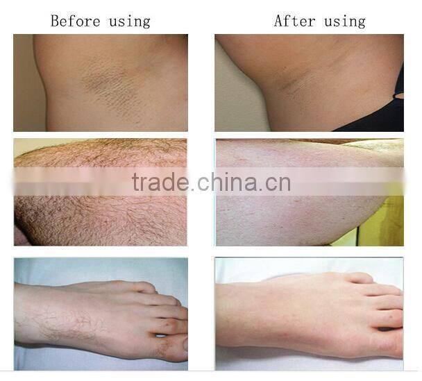 Customized Diode hair Laser treatment With Stable Function 10 Different Language