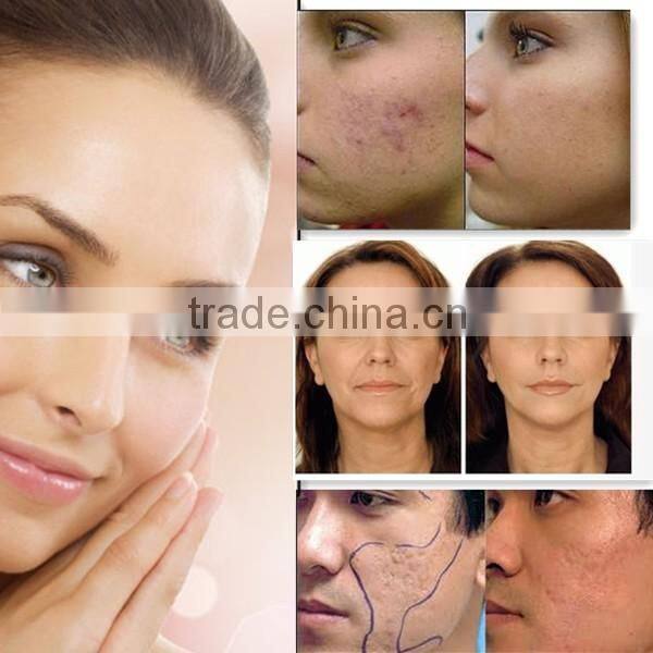 portable pdt beauty equipment