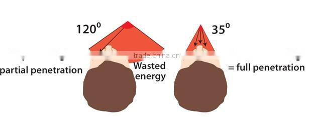 3 in 1 PDT LED focus light RF Vacuum infrared microdermabrasion skin rejuvenation equipment