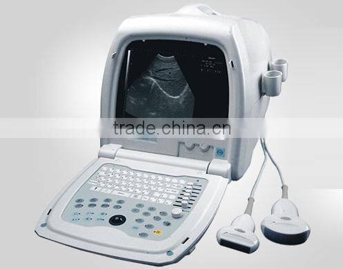 2015 Most Popular ultrasonic equipment