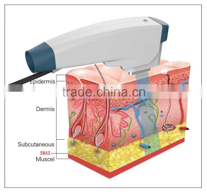 Newest Skin Tightening Face Lifting RF Machine