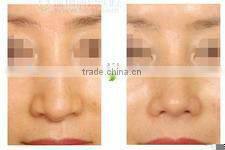 2013 new design E light beauty machine