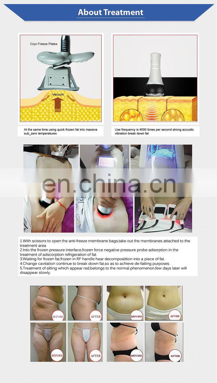 Cryotherapy machine for sale/cryo facial slimming machine