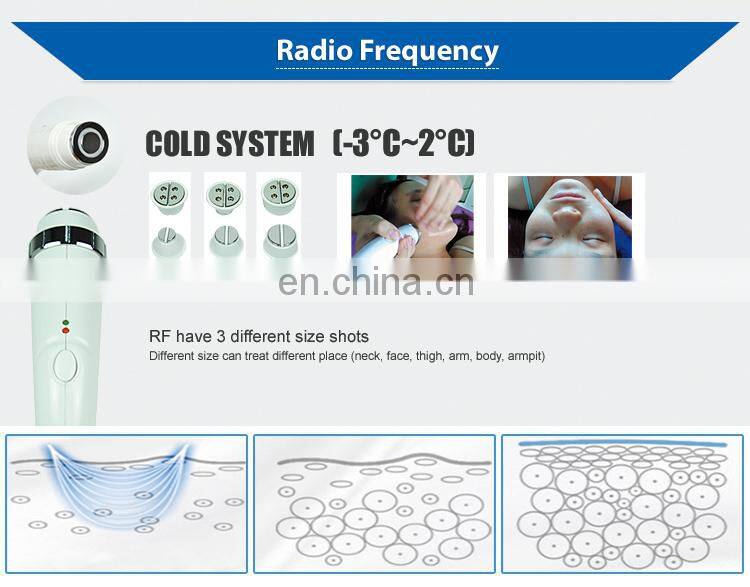 OPT ND YAG LASER RF Beauty Machine Elight Multi-functional Tattoo Removal Hair Removal