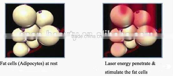 Hot selling Black baby laser cleaning machine