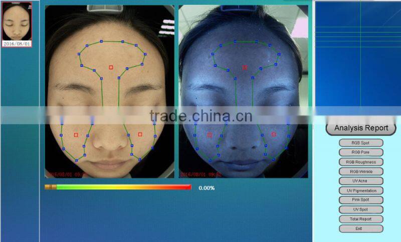Best sell UV light skin scanner machine detect deep skin moisture content