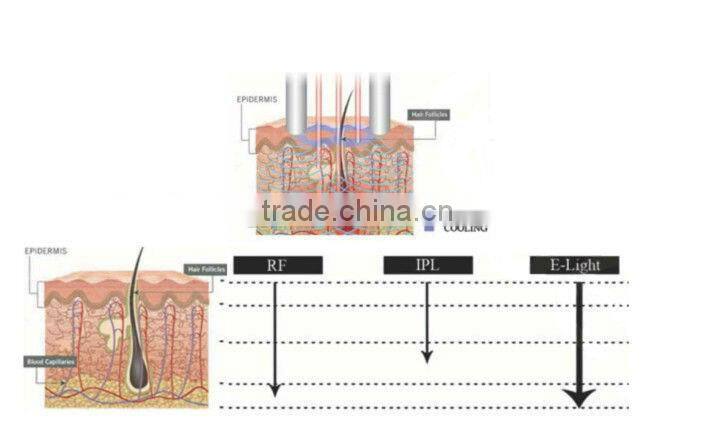 Elight ipl hair removal machine for sale C001