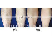 2013 new upgraded mini hair removal ipl machine