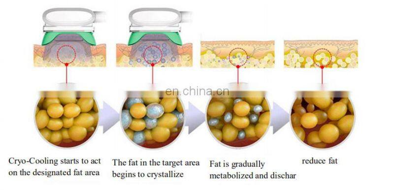 New technology 360 cryo fat freezing electromagnetic abdominal muscle stimulator hip trainer