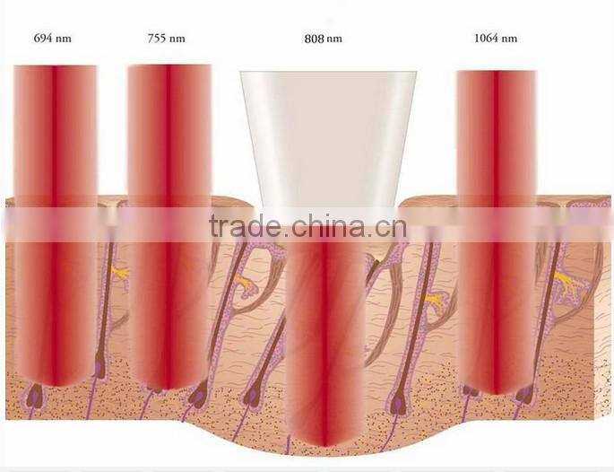 Y8 CE approved professional 808nm laser diode hair removal machine