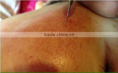 factory price best beauty device / facial veins removal / laser varicose veins treatment