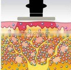 Manufacturer 2014 Mesotherapy Skin Rejuvenation RF facial Machine