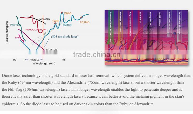 CE Approved 808nm Diode Laser Hair Removal Machine