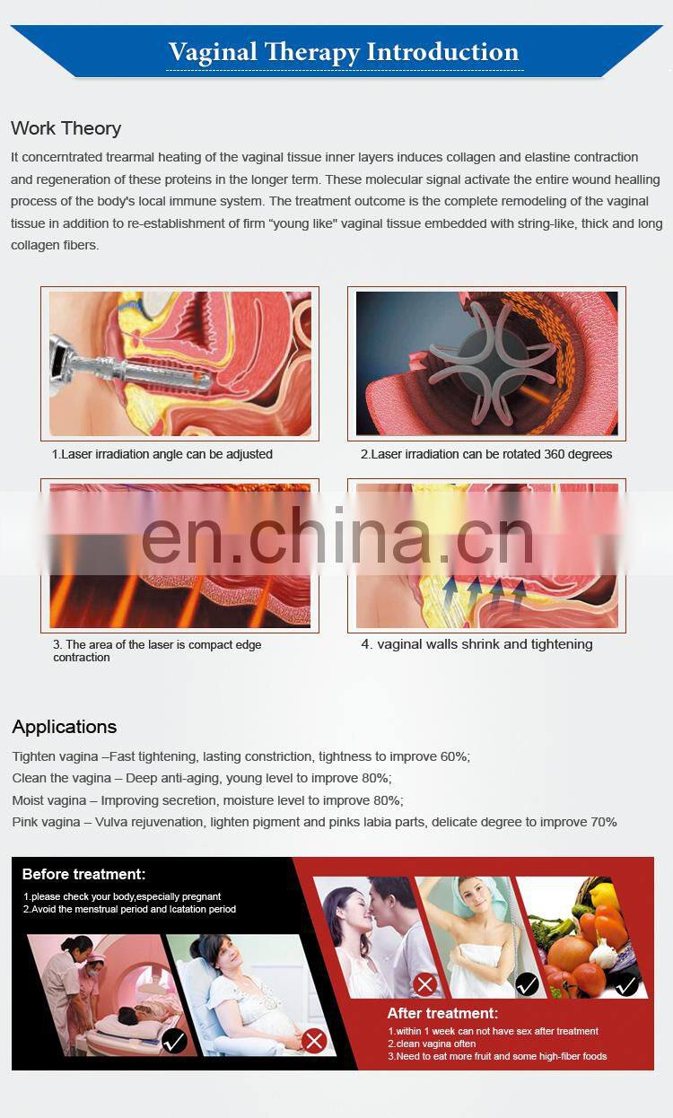 salon equipment Vaginal tightening fractional co2 laser machine co2 fractional laser devices