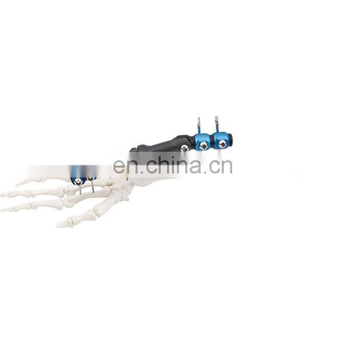 High Quality Wrist Joint External Fixator Orthopedic Surgical Instrument