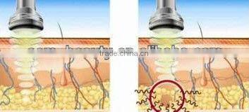 2013 cellulite treatment ultrasonic cavitation slimming machine with RF for men and women