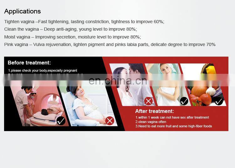 Medical viginal tightening co2 laser machine portable