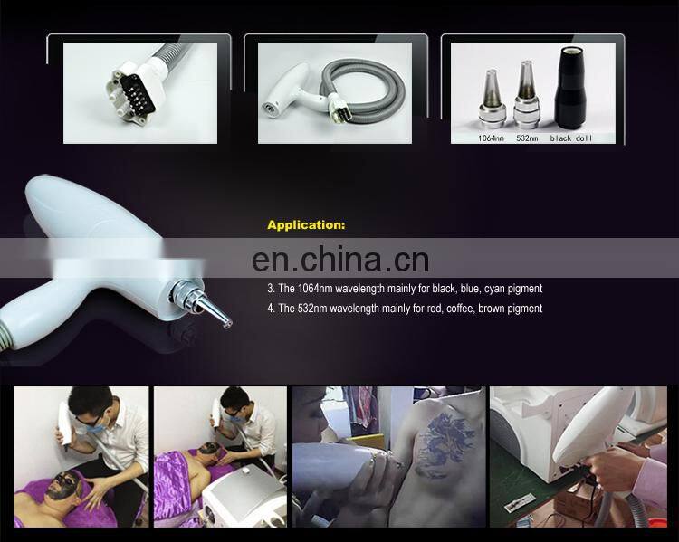 Manufacturer hot selling laser tattoo removal machine price/removal tattoo laser machine