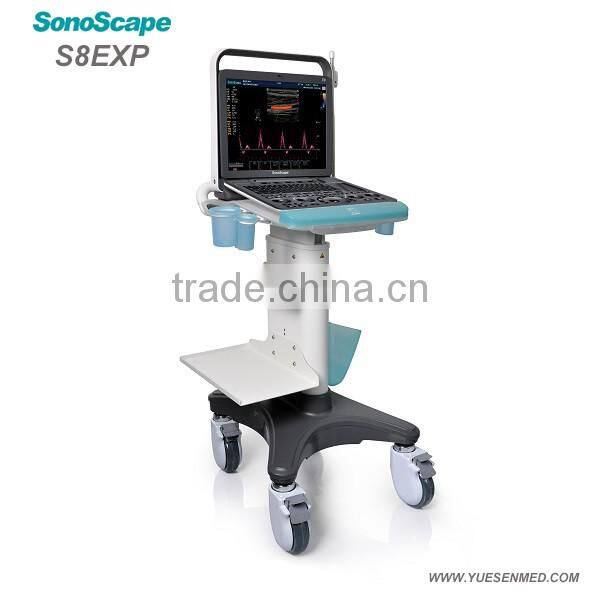 Sonoscape S8Exp Portable Color Doppler Ultrasound Machine