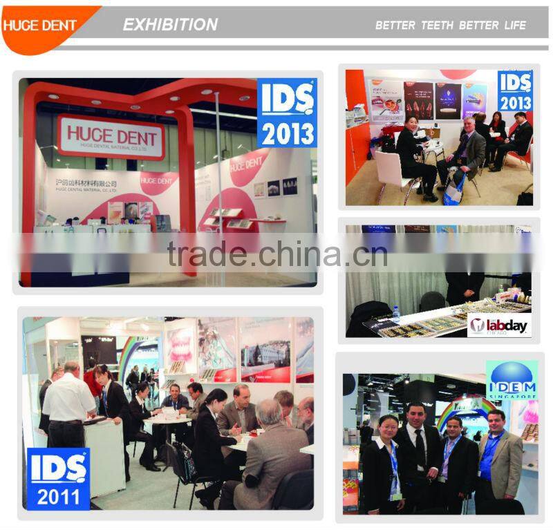 Huge Dental Sonning Full set Acrylic Denture Teeth