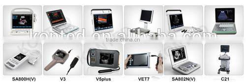 C7 KONTED 3D Portable Color Doppler Ultrasound Machine