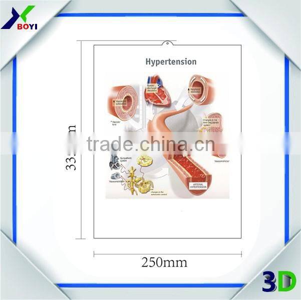 plastic embossed 3d medical poster/anatomical chart (teeth)