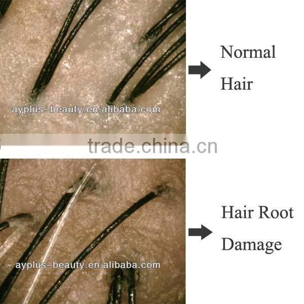 AYJ-J015(CE)Newest 5MP digital hair wood lamp skin analyzer/body skin hair analyser/3d skin analyzer/hair detector